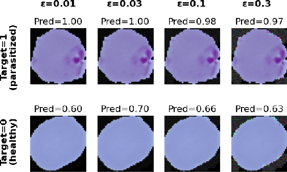 Figure 1 for Out of Distribution Detection and Adversarial Attacks on Deep Neural Networks for Robust Medical Image Analysis