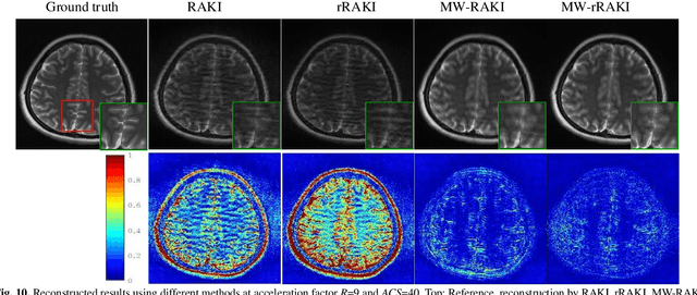 Figure 2 for Multi-Weight Respecification of Scan-specific Learning for Parallel Imaging