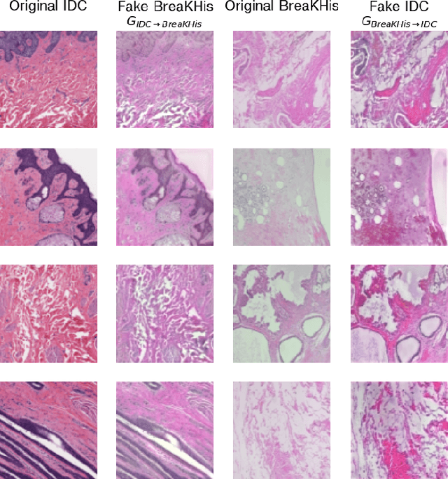 Figure 4 for From CNNs to Vision Transformers -- A Comprehensive Evaluation of Deep Learning Models for Histopathology