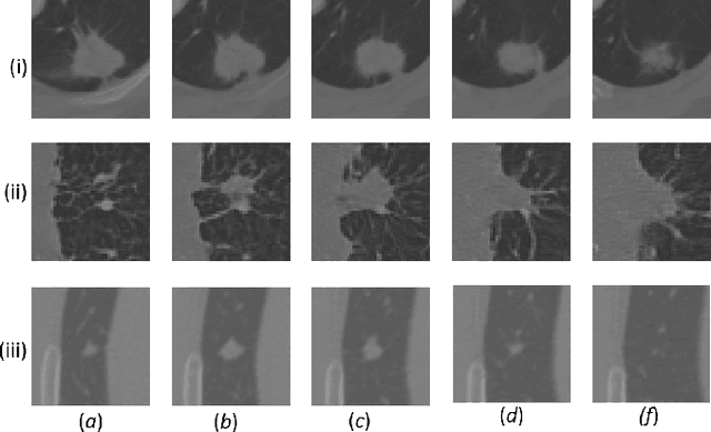 Figure 1 for Volumetric Lung Nodule Segmentation using Adaptive ROI with Multi-View Residual Learning