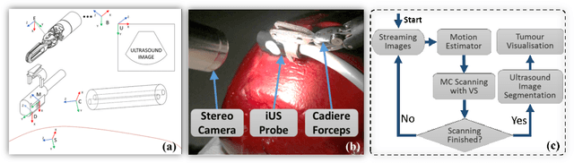 Figure 1 for Motion-Compensated Autonomous Scanning for Tumour Localisation using Intraoperative Ultrasound