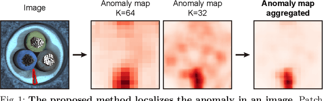 Figure 1 for Patch SVDD: Patch-level SVDD for Anomaly Detection and Segmentation