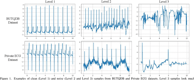 Figure 1 for Automatic Detection of Noisy Electrocardiogram Signals without Explicit Noise Labels