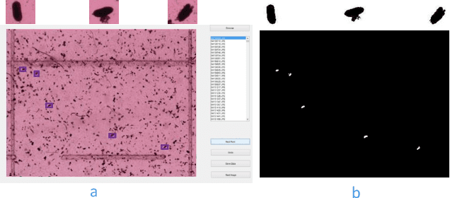 Figure 1 for An end-to-end convolutional selective autoencoder approach to Soybean Cyst Nematode eggs detection