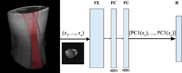 Figure 1 for Estimating Achilles tendon healing progress with convolutional neural networks