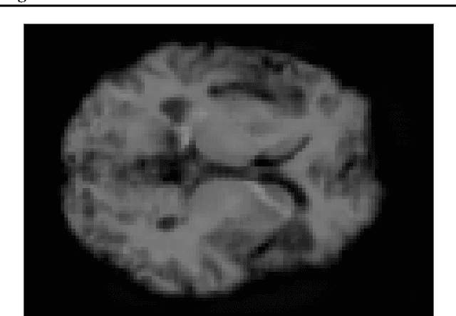 Figure 3 for Highly Accurate FMRI ADHD Classification using time distributed multi modal 3D CNNs