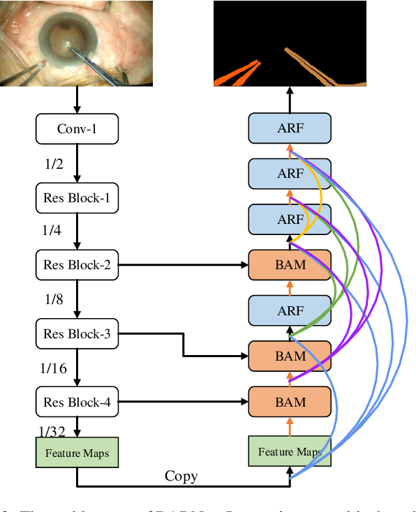 Figure 3 for BARNet: Bilinear Attention Network with Adaptive Receptive Field for Surgical Instrument Segmentation