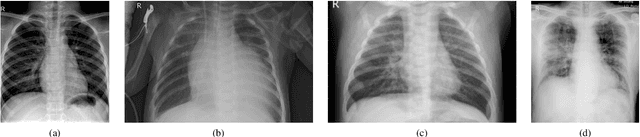Figure 1 for Study on Transfer Learning Capabilities for Pneumonia Classification in Chest-X-Rays Image