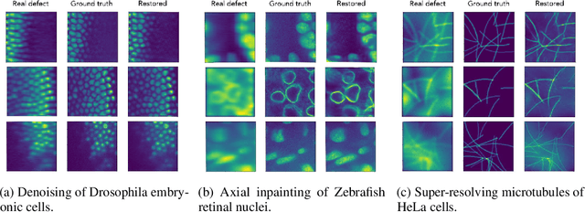 Figure 3 for Multi-defect microscopy image restoration under limited data conditions