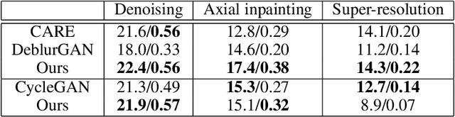 Figure 4 for Multi-defect microscopy image restoration under limited data conditions