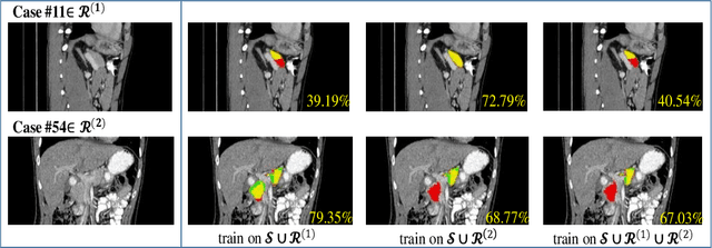 Figure 1 for ATSO: Asynchronous Teacher-Student Optimizationfor Semi-Supervised Medical Image Segmentation