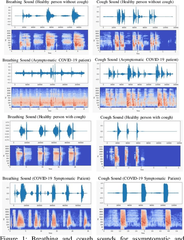Figure 2 for QUCoughScope: An Artificially Intelligent Mobile Application to Detect Asymptomatic COVID-19 Patients using Cough and Breathing Sounds