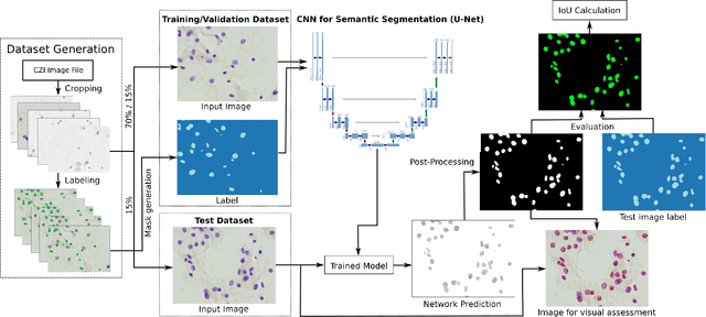 Figure 1 for Towards a Complete Pipeline for Segmenting Nuclei in Feulgen-Stained Images
