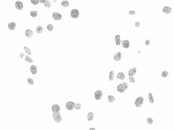 Figure 4 for Towards a Complete Pipeline for Segmenting Nuclei in Feulgen-Stained Images