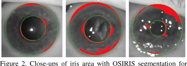 Figure 3 for Human Iris Recognition in Post-mortem Subjects: Study and Database