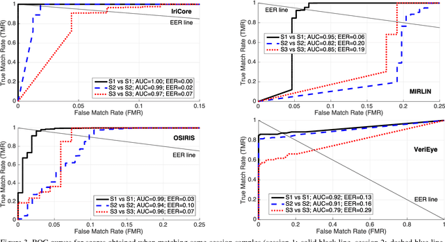 Figure 4 for Human Iris Recognition in Post-mortem Subjects: Study and Database