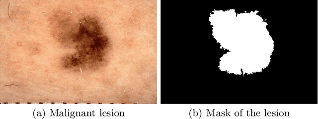 Figure 4 for Patch Selection for Melanoma Classification