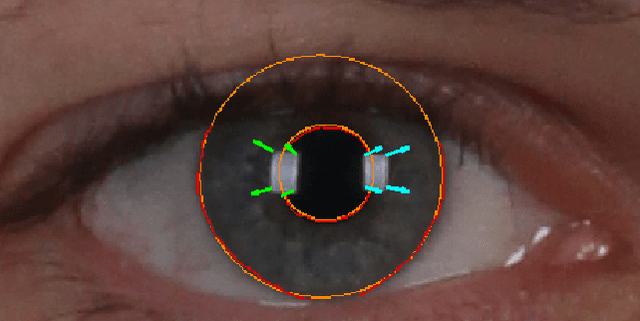 Figure 2 for Reflection Analysis for Face Morphing Attack Detection