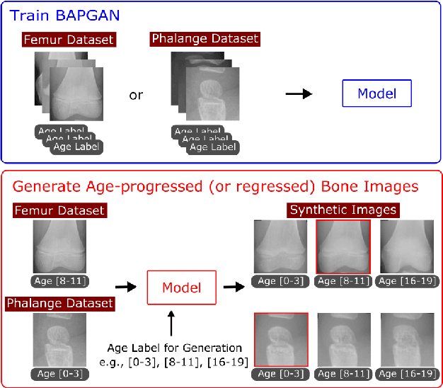 Figure 1 for BAPGAN: GAN-based Bone Age Progression of Femur and Phalange X-ray Images