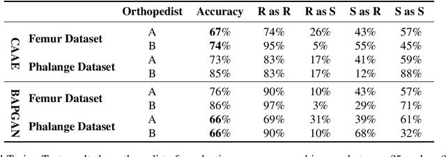 Figure 4 for BAPGAN: GAN-based Bone Age Progression of Femur and Phalange X-ray Images