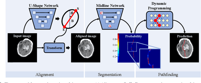 Figure 3 for Segmentation-based Method combined with Dynamic Programming for Brain Midline Delineation