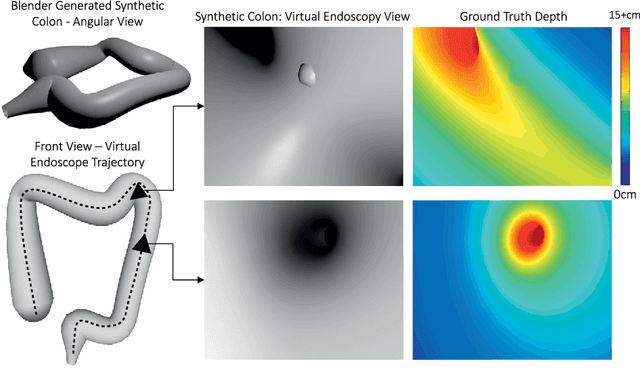 Figure 1 for Deep Learning and Conditional Random Fields-based Depth Estimation and Topographical Reconstruction from Conventional Endoscopy