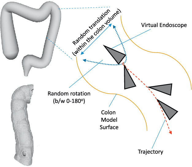 Figure 3 for Deep Learning and Conditional Random Fields-based Depth Estimation and Topographical Reconstruction from Conventional Endoscopy