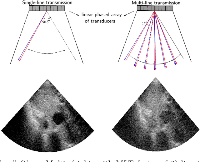 Figure 1 for High quality ultrasonic multi-line transmission through deep learning