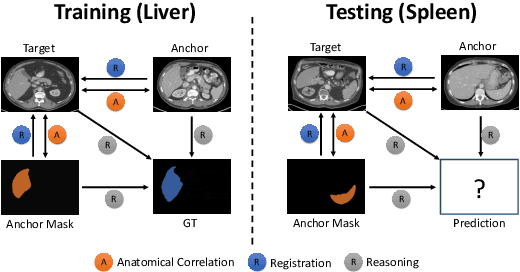 Figure 1 for Generalized Organ Segmentation by Imitating One-shot Reasoning using Anatomical Correlation