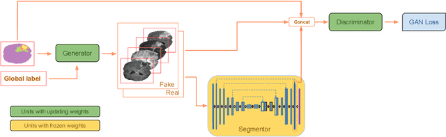 Figure 3 for Red-GAN: Attacking class imbalance via conditioned generation. Yet another medical imaging perspective