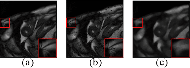 Figure 1 for SEGAN: Structure-Enhanced Generative Adversarial Network for Compressed Sensing MRI Reconstruction