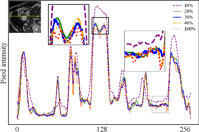 Figure 4 for SEGAN: Structure-Enhanced Generative Adversarial Network for Compressed Sensing MRI Reconstruction