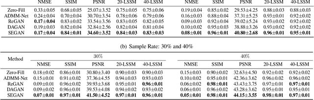 Figure 2 for SEGAN: Structure-Enhanced Generative Adversarial Network for Compressed Sensing MRI Reconstruction