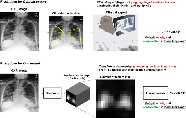 Figure 1 for Vision Transformer using Low-level Chest X-ray Feature Corpus for COVID-19 Diagnosis and Severity Quantification