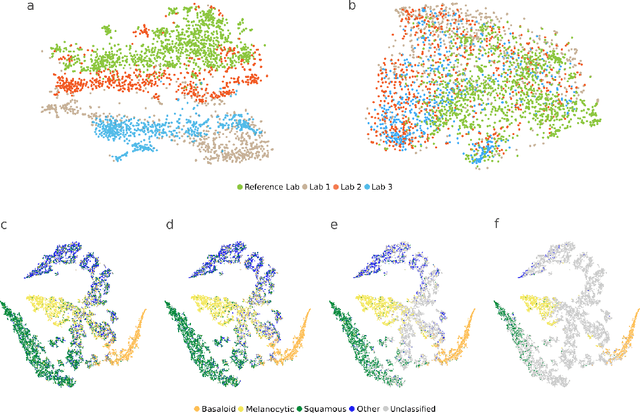 Figure 4 for Augmenting the Pathology Lab: An Intelligent Whole Slide Image Classification System for the Real World