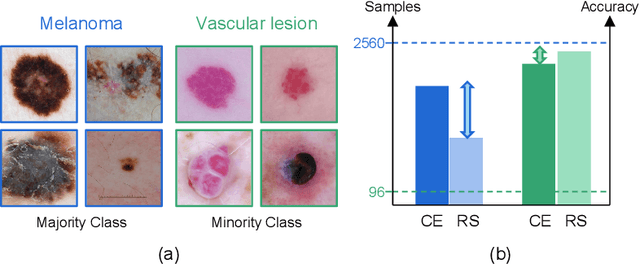 Figure 1 for Flexible Sampling for Long-tailed Skin Lesion Classification