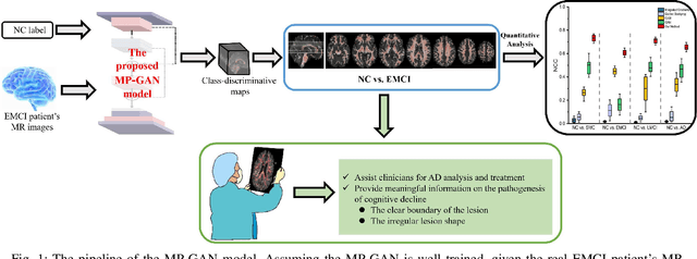 Figure 1 for Morphological feature visualization of Alzheimer's disease via Multidirectional Perception GAN
