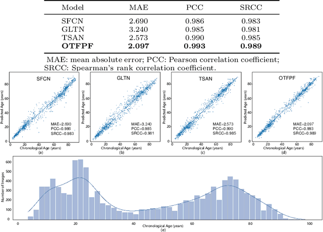 Figure 3 for OTFPF: Optimal Transport-Based Feature Pyramid Fusion Network for Brain Age Estimation with 3D Overlapped ConvNeXt