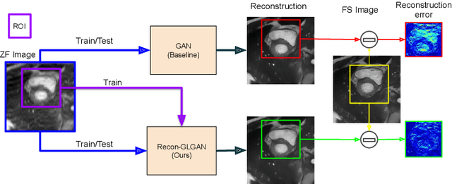 Figure 1 for Recon-GLGAN: A Global-Local context based Generative Adversarial Network for MRI Reconstruction