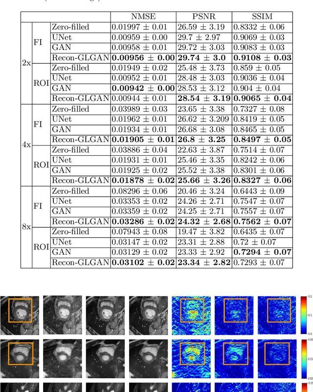 Figure 2 for Recon-GLGAN: A Global-Local context based Generative Adversarial Network for MRI Reconstruction