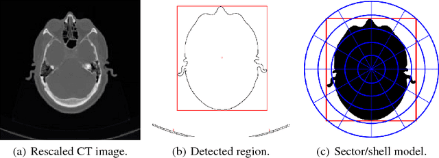 Figure 1 for A deep learning-based method for relative location prediction in CT scan images