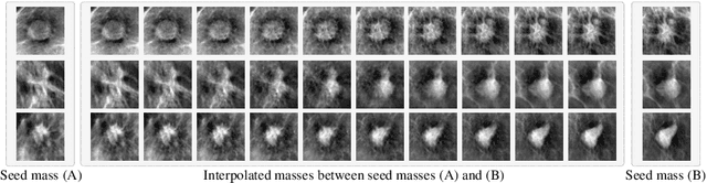 Figure 3 for Feature2Mass: Visual Feature Processing in Latent Space for Realistic Labeled Mass Generation