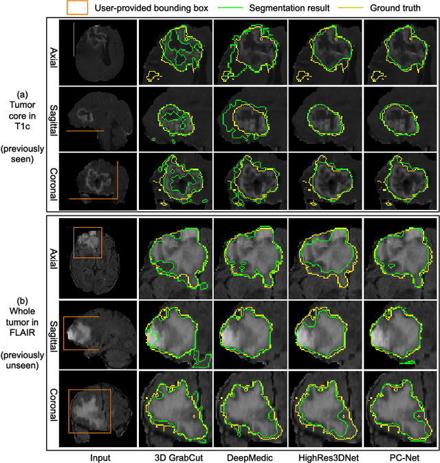 Figure 2 for Interactive Medical Image Segmentation using Deep Learning with Image-specific Fine-tuning