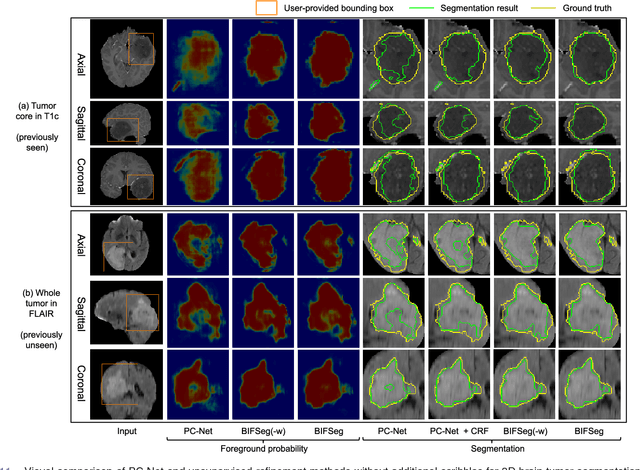 Figure 3 for Interactive Medical Image Segmentation using Deep Learning with Image-specific Fine-tuning