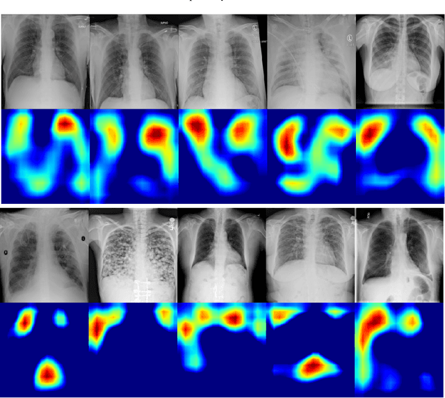 Figure 4 for Synthetic COVID-19 Chest X-ray Dataset for Computer-Aided Diagnosis