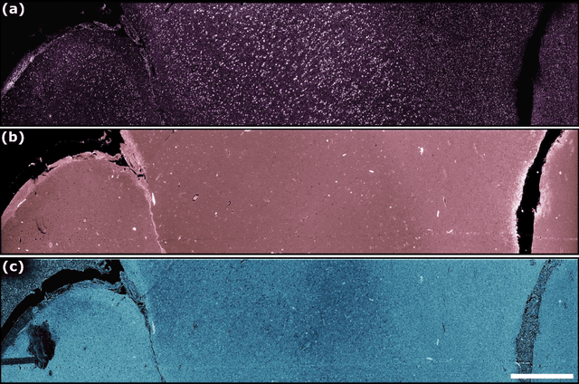 Figure 4 for Label-free virtual Hematoxylin and Eosin (H&E) staining using second generation Photoacoustic Remote Sensing (PARS)