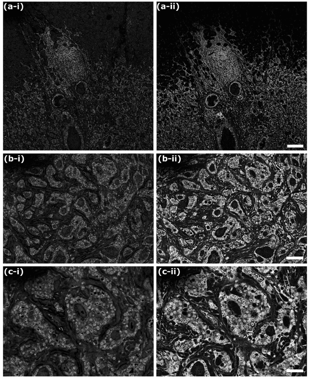 Figure 1 for Label-free virtual Hematoxylin and Eosin (H&E) staining using second generation Photoacoustic Remote Sensing (PARS)
