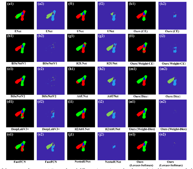 Figure 3 for Adversarial Multiscale Feature Learning for Overlapping Chromosome Segmentation
