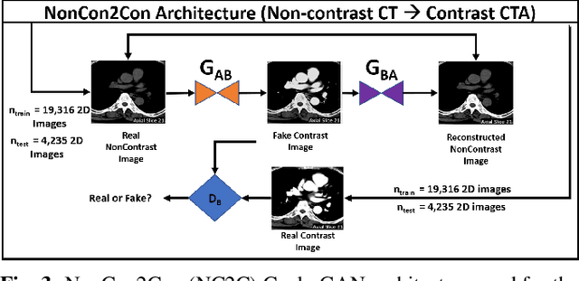 Figure 3 for A Deep learning Approach to Generate Contrast-Enhanced Computerised Tomography Angiography without the Use of Intravenous Contrast Agents