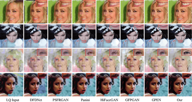 Figure 4 for Enhancing Quality of Pose-varied Face Restoration with Local Weak Feature Sensing and GAN Prior